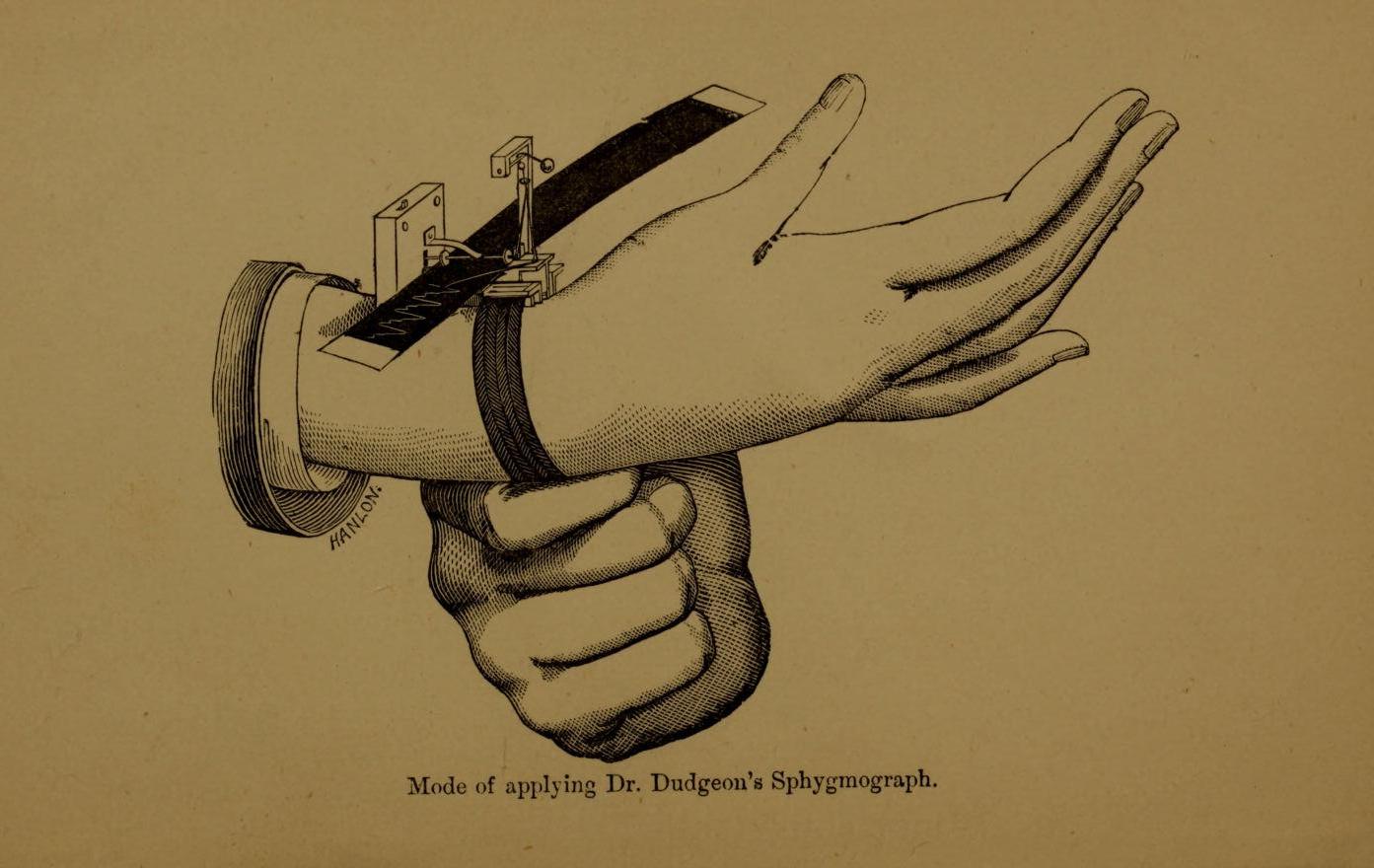 Sphygmograph
