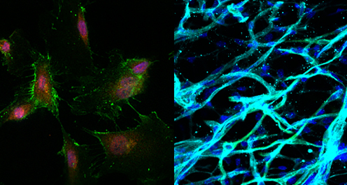 Stem cells (left) were used to create new blood vessels (right).