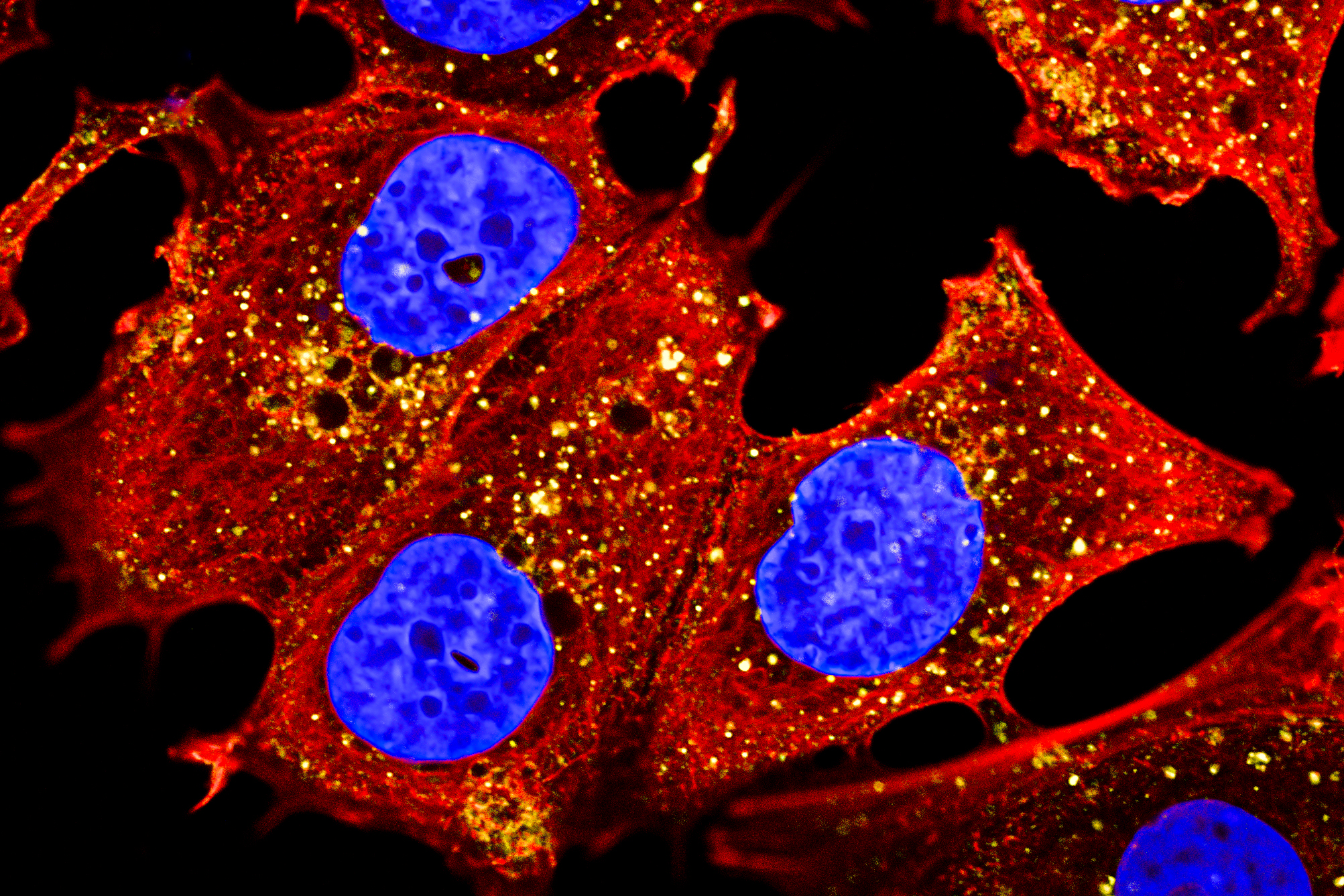 Internalisation of Monoclonal Antibodies in Breast Cancer Cells