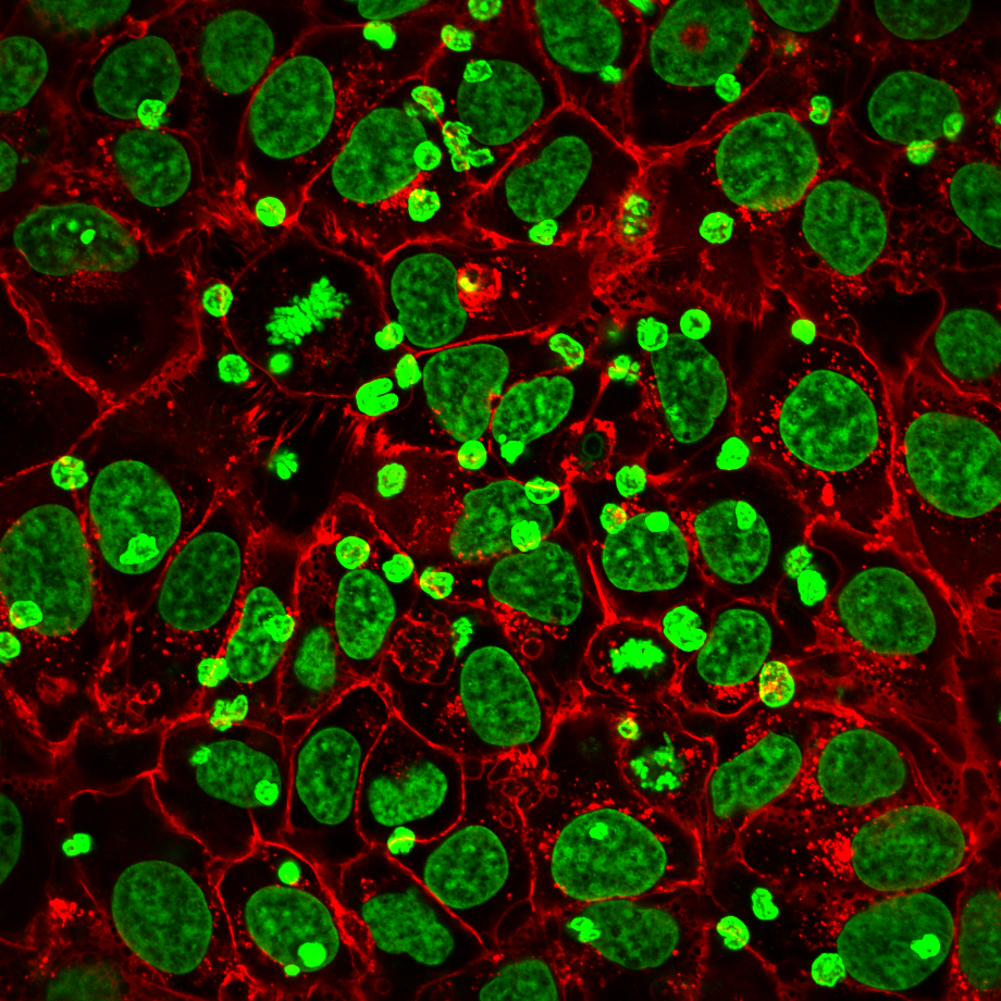 Immune Cells Attacking Cancer