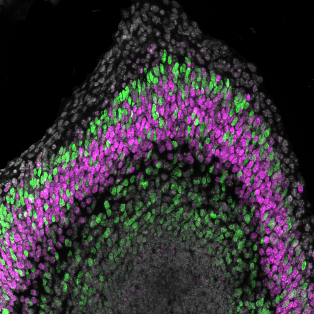 Neuronal Populations Immunostaining in Mouse Cortex