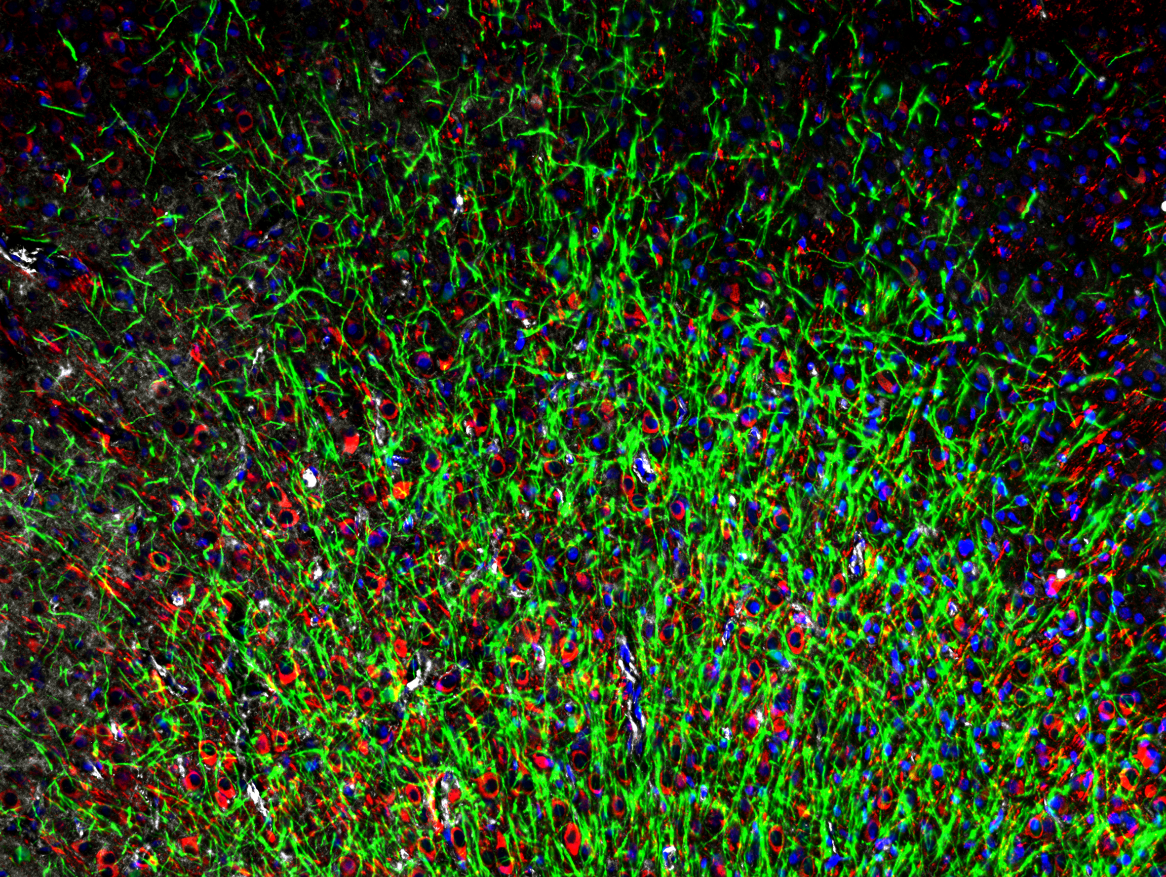 Networks in the growth restricted brain