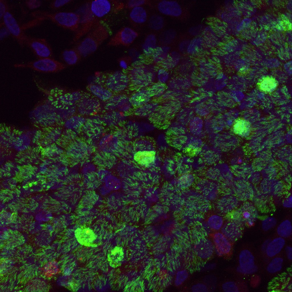 Primary Human Nasal Epithelial Cells