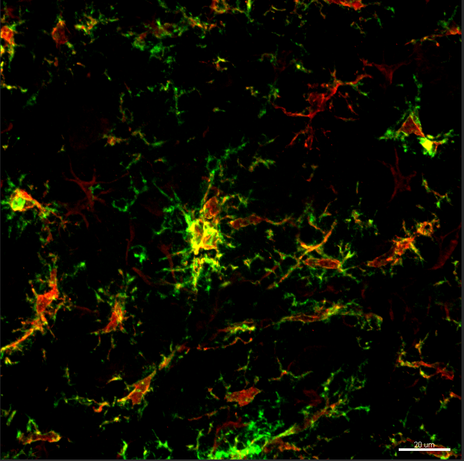 A Microglial Menagerie