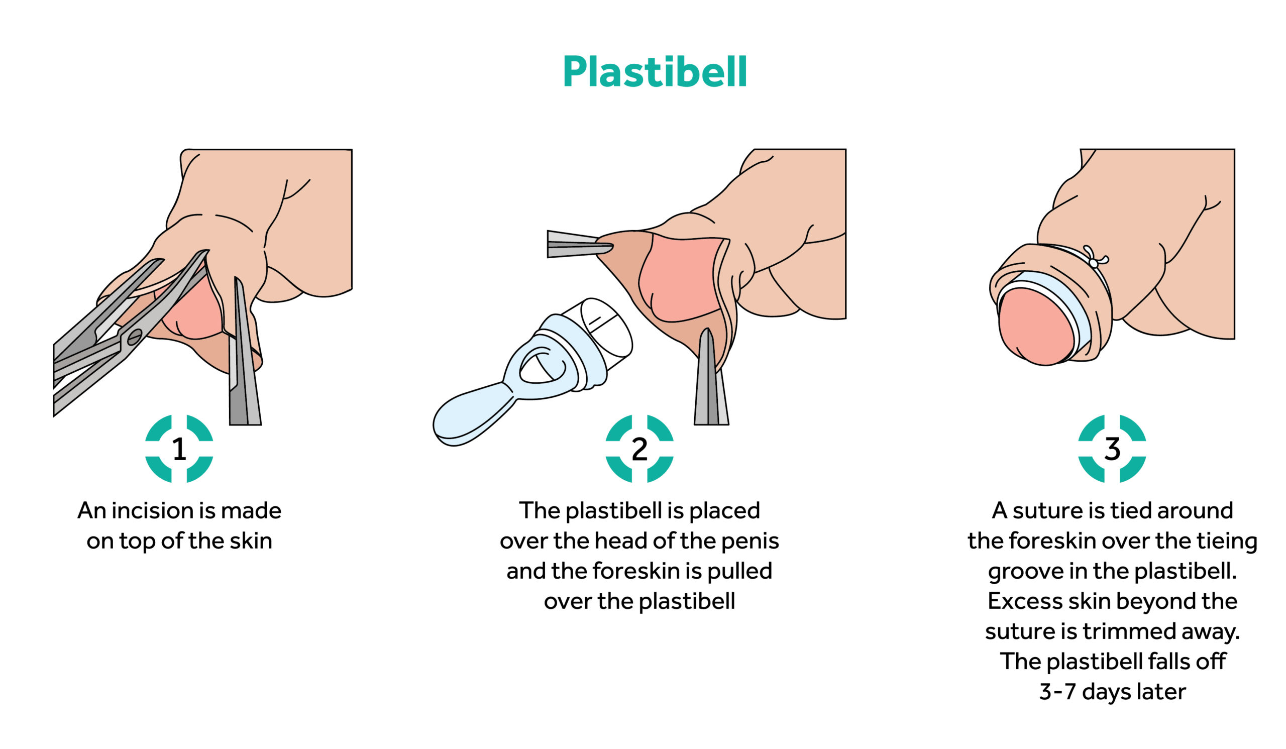 Plastibel instruction sheet