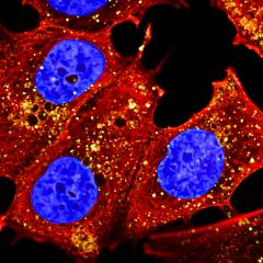 Internalisation of monoclonal antibodies in breast cancer cells
