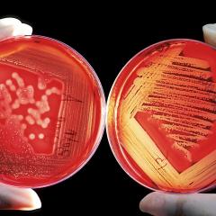 Antibiotic development