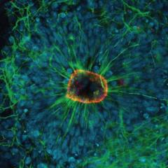 Red: Tight junction marker (Zo-1) demonstrating the apical surface. Green: Cytoskeleton marker (TUBB-3) showing the radial structure of the rosettes. Blue: Nucleus of cells (DAPI)