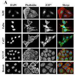 Green colour shows E2F7 that has leaked out of the nucleus in drug resistant cancer cells.