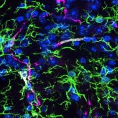 Exercise can help slow cognitive decline