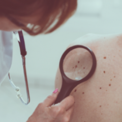 Doctor checking patient's skin with magnifying glass