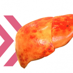fatty liver