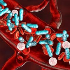 Sepsis