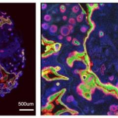 A skin organoid, stained with key human skin markers, at 90 days differentiation. The blue colour marks the cell nucleus, green is Keratin 10 and red is Keratin 19.