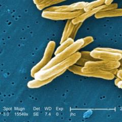 Promising new method inhibits TB-causing bacteria