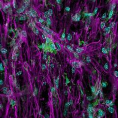 Inflammation after spinal cord injury. Image source: Ms Faith Brennan (UQ School of Biomedical Sciences) and Mr Luke Hammond (UQ Queensland Brain Institute).
