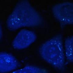 Cholesterol in cells