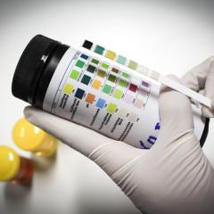What can your doctor tell from your urine?