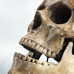 Professor Emma Duncan explains why bones are important.