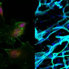 Stem cells (left) were used to create new blood vessels (right).