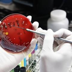 Image of bacteria in laboratory culture