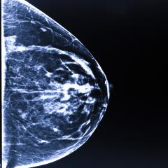 A step closer to personalised breast cancer treatment