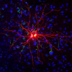 Image of a neurone